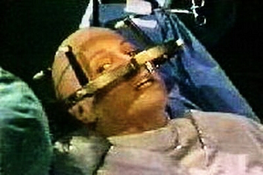 MD-001